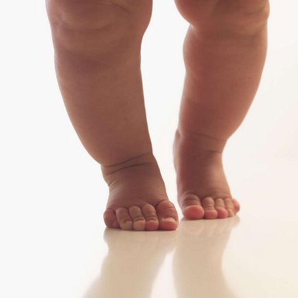 Дитина ходить на носочках причини і поради фахівців