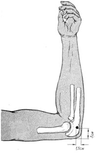 Schema de tracțiune 1