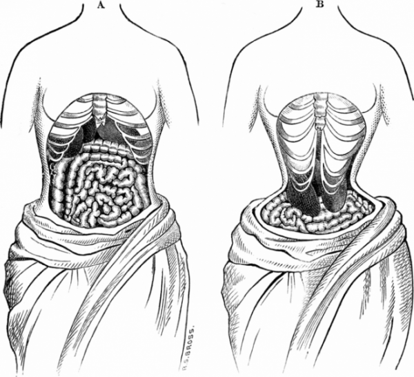 Tabletă cu ouă de vierme - o dietă amețitoare a femeilor victoriene de modă