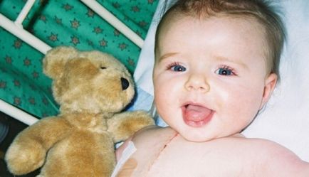 Tetralogia falului la copii și tratamentul nou-născut, operație