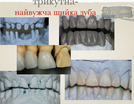 Трикутні і овальні зуби