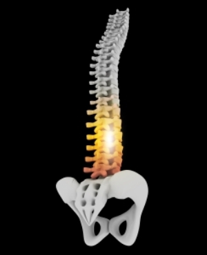 Tuberkolitikus spondylitis - tünetek és kezelés