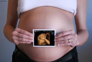 Megtudhatja, milyen gyakran lehet csinálni terhességi ultrahang
