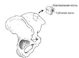 Variante de reconstrucție a maxilarului inferior