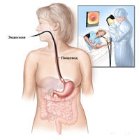 Astmul gastric