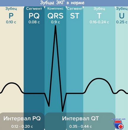 Barb s egy EKG-