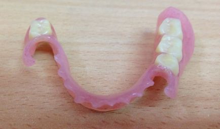 Denture detașabil nailon - preț și fotografie