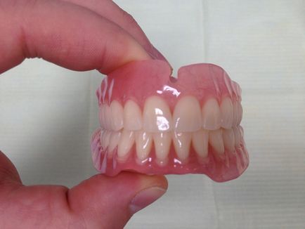 Зубні протези знімні нейлонові - ціна і фото