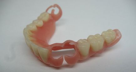 Denture detașabil nailon - preț și fotografie