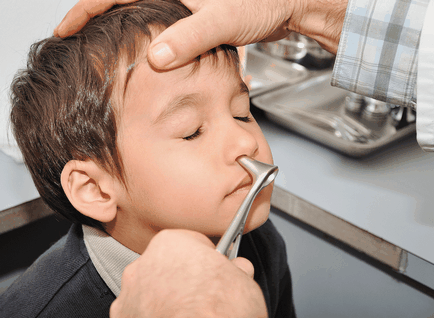 Adenoide 1 grad în simptomele copilului și principiile moderne de tratament, gât