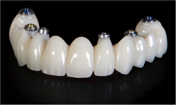 Stomatologia stomatologică Implantul în absența totală a dinților
