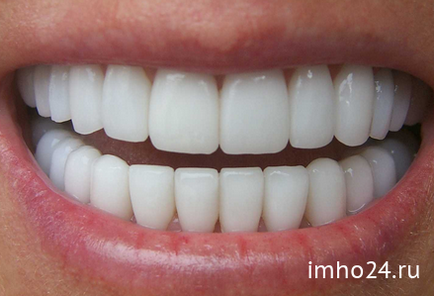 Blanx white shock для відбілювання зубів відгуки