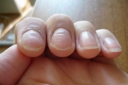 Що робити, якщо нігті стали хвилястими, красиві нігті - додаток твого образу