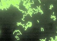 Що ми знаємо про кондиціонери чому кондиціонер перетворюється на розсадник бактерій