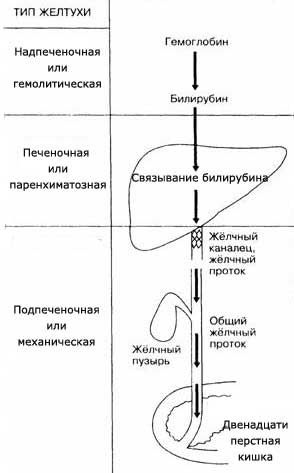 Що таке механічна жовтяниця