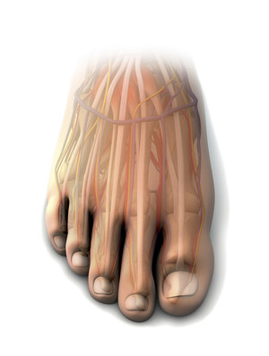 Cросшіеся пальці на ногах фото і причини патології - woman s day