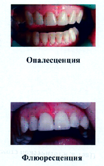 Culoare în stomatologie estetică - Portalul dentar Volgograd 1