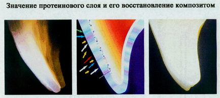 Culoare în stomatologie estetică - Portalul dentar Volgograd 1