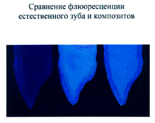 Culoare în stomatologie estetică - Portalul dentar Volgograd 1