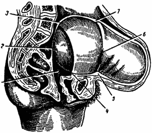 Diagnosticarea unei rupturi uterine amenințătoare, obstetrică