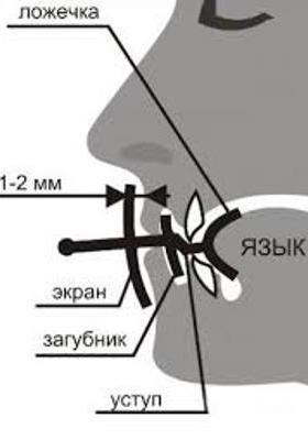 Екстра-лор від хропіння відгуки від використання і ціна на пристрій