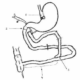 Evoluția chirurgiei obezității în Rusia