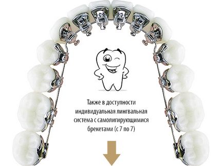Centrul Ortodontic European din Tyumen, centru ortodontic european & orto-revoluție de laborator