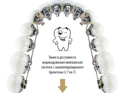 Європейський ортодонтичний центр в Тюмені, european orthodontic center & amp; ortho revolution lab