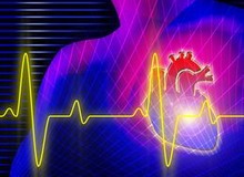 Factori de risc pentru boli cardiovasculare, sănătate de dans aerobic de fitness, fitness de dans 1