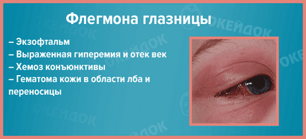 cellulitis szemek