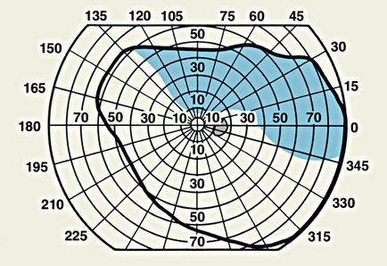 Schimbarea câmpurilor vizuale ale ochiului - cauze, diagnostic și tratament