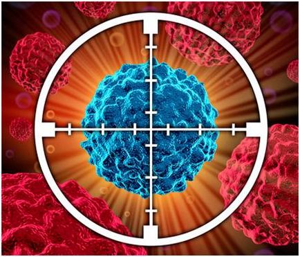 Cum se trateaza melanomul la diferite stadii de inovare in tratament, cartea de rezerva
