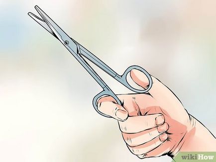 Як знімати шви