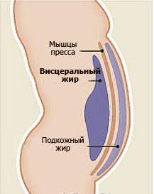 Cum se elimină grăsimea viscerală de pe stomac