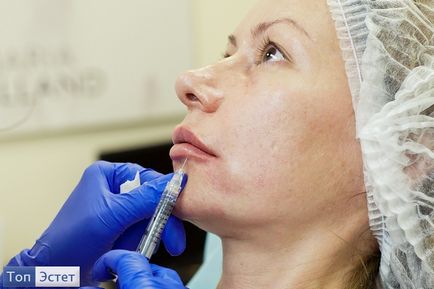 Hogyan növelni az ajkak műtét nélkül töltőanyagok, mezoniti, tetoválás, elektroppratsiya
