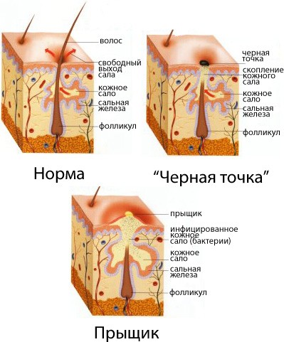 Шкірні хвороби людини фото і опис лікування захворювання