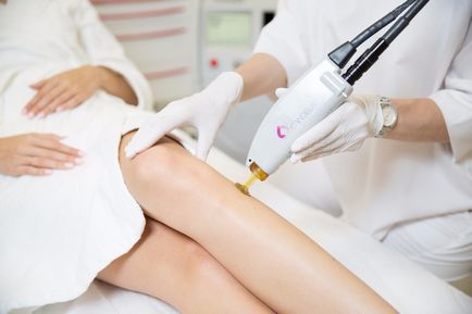 Laser Hair Removal Hip Avantaje și caracteristici