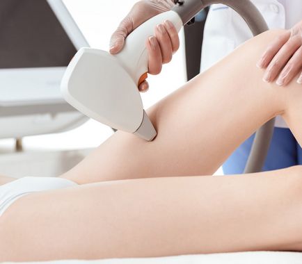 Лазерна епіляція ніг (гомілок, стегон) для жінок - epilas
