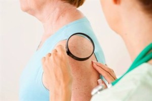 Tratamentul melanomului după o intervenție chirurgicală - o scurtă descriere și modalități de tratament