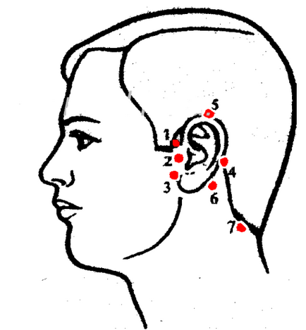 Лікування п'явками вух