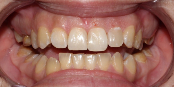 Лікування зубів санкт-петербург відгуки, ціни, адреси стоматології