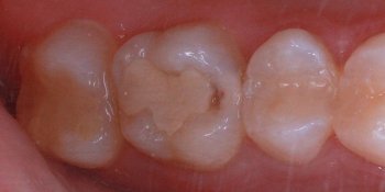 Лікування зубів санкт-петербург відгуки, ціни, адреси стоматології