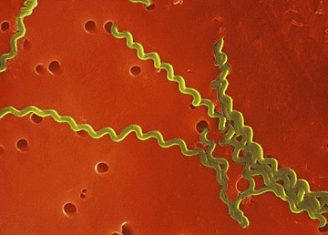 Leptospiroza la câini (icterul infecțios), simptome, tratament, prevenire, diagnostic, simptome