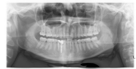 Kutatási módszerek a fogászatban panoráma kép, X-ray