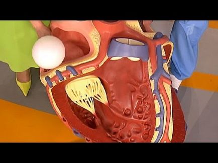 Mecanismele inimii, atriul stâng cauzează ceea ce este