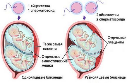 Багатоплідна вагітність як особливість зачаття (відео)