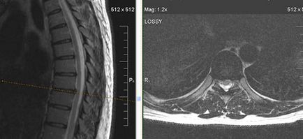MRI szakértő mri fájdalom szindróma a hátsó (háti gerinc MRI)