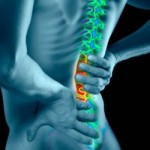 Metode populare de tratament a herniei de coloana vertebrală în condiții de casă