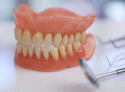 Ні зубів повні та часткові зубні протези - дізнайся, які краще!