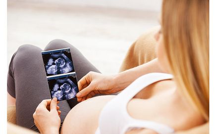 magzati vizsgálata a terhesség alatt (a terhesség Doppler) magzati vizsgálat a terhesség alatt